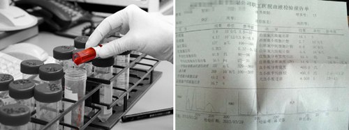 郑州痛风风湿病医院尿酸检测.jpg