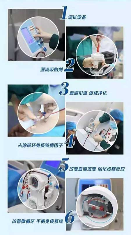 IA免疫吸附技术步骤解析图.jpg